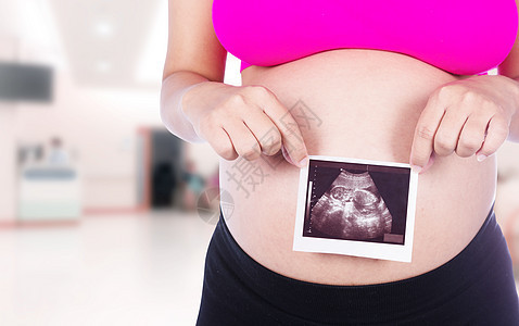 持有超声波照片的孕妇双手 在医院背景中父母身体扫描卫生男生保健性别腹部婴儿孩子图片