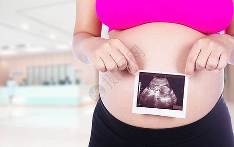 持有超声波照片的孕妇双手 在医院背景中婴儿身体怀孕孩子母亲扫描腹部女性卫生肚子图片