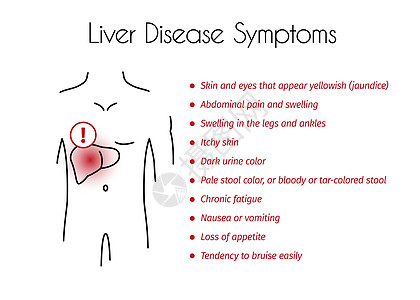 年轻马的矢量肝病症状信息图图片