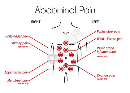 腹痛类型的矢量图图片