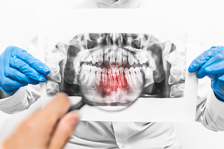 牙科医生用蓝乳胶手握有医疗手套 对嘴部进行X光片照 并用放大镜 闭紧的玻璃检查图片