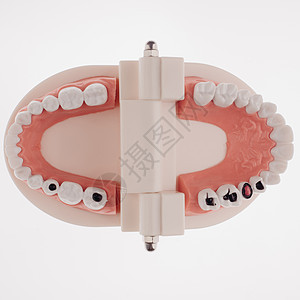 培训白色背景的牙科下巴布局假肢牙齿牙医病人金属矫正治疗微笑男人假牙图片