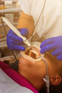 牙医用超声波检查取出牙科病人的防晒油 将嘴唇和口香糖隔离开来矫正考试牙齿手术工具临床卫生牌匾药品检查图片