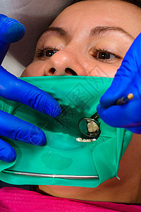 牙医用橡胶大坝 钻孔 镜子来治疗病人的牙齿临床医生牙科橡皮障咨询卫生椅子盘子程序口腔科图片