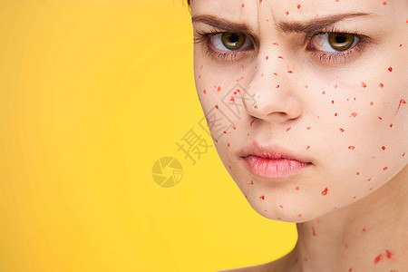 脸部有红点的女子 皮肤问题皮肤病不满意爸爸物质刺激青春痘牙裔头发成人疙瘩药品面具图片