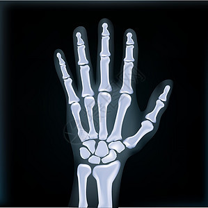 现实的X射线手提医疗图象图片