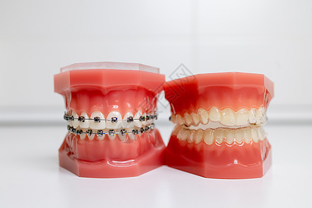 牙套在下巴牙牙上的口罩和牙齿模型微笑个人手套医生牙医外科护理技术手术口腔图片