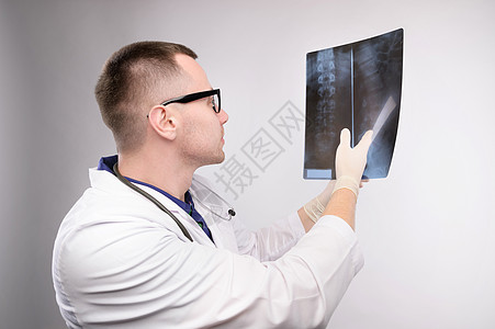 年轻的白人医生放射科医生正在看 X 光片 一位身穿白大衣 戴眼镜 带听诊器的医生手里拿着 X 光片医院男人工人医师外科保健职业男图片