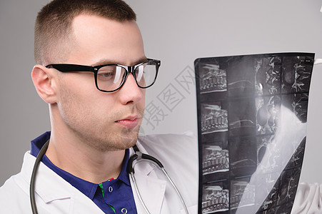 年轻的白人医生放射科医生正在看 X 光片 一位身穿白大衣 戴眼镜 带听诊器的医生手里拿着 X 光片医师男人工作药品保健白色医院男图片