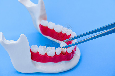 从下下巴模型中拔牙的tweezers假肢微笑口腔科王冠塑料口服手术卫生假牙外科背景图片