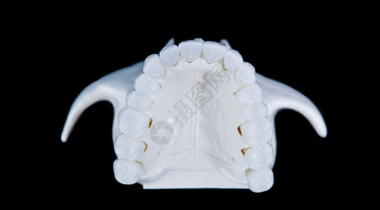 上人下巴 其牙齿在黑色背景上被隔绝实验室技术矫正手术口服健康口腔科假肢牙医假牙图片
