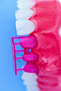 植牙和安装树冠工艺程序工具牙医牙齿手术卫生假牙口服技术植入物外科图片