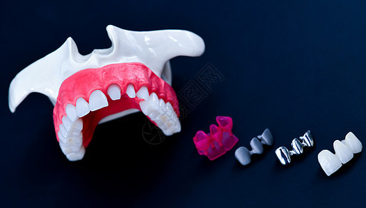 植牙和安装树冠工艺程序工具蓝色技术药品植入物替代品教学诊所卫生牙齿图片