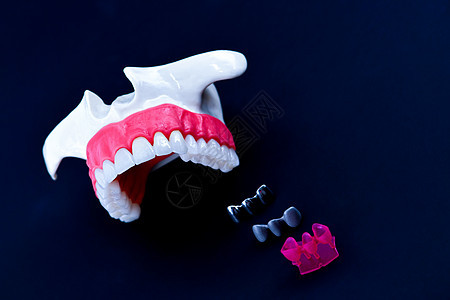 植牙和安装树冠工艺程序口服技术牙科替代品假肢医生牙龈工具蓝色牙医图片