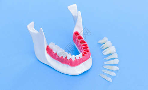 植牙和安装树冠工艺程序外科牙医植入物诊所牙齿牙龈口服单板教学技术图片