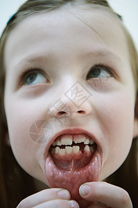 小女孩没有牙齿的笑容差距卫生孩子们童年生长喜悦牙医幸福乐趣牙科图片