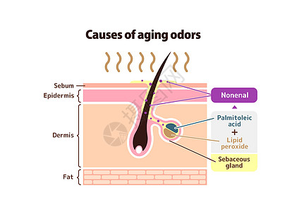 久老的臭气矢量说明的原因身体插图真皮大汗腺老年皮脂腺体味厌恶皮肤气味图片