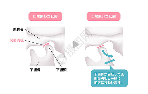 开启和特写下巴时的结构插图Name解剖学骨骼生物学障碍下颌身体牙齿矫正药品面部图片