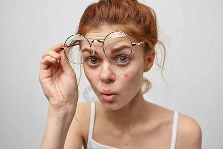 戴眼镜的红发女人脸上长痘痘皮肤护理图片