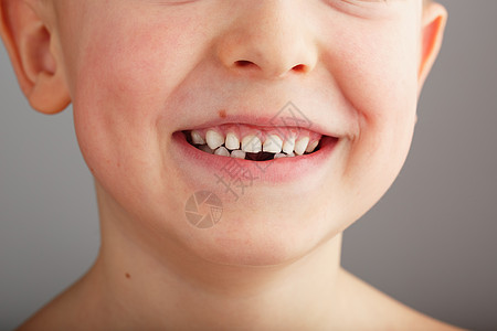 没有下乳牙的孩子的笑容 孩子笑容中的一个洞 有趣的概念生长鼻子治愈冲洗牙膏牛奶婴儿曲线程序女孩图片