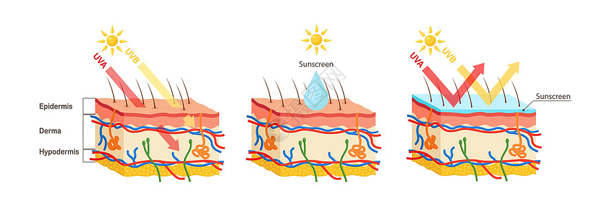 UV防护 日光屏润滑剂保护人类皮肤免受UVA UVB射线的辐射图表棕褐色晒斑反射信息渗透阳光癌症防晒霜晒黑图片