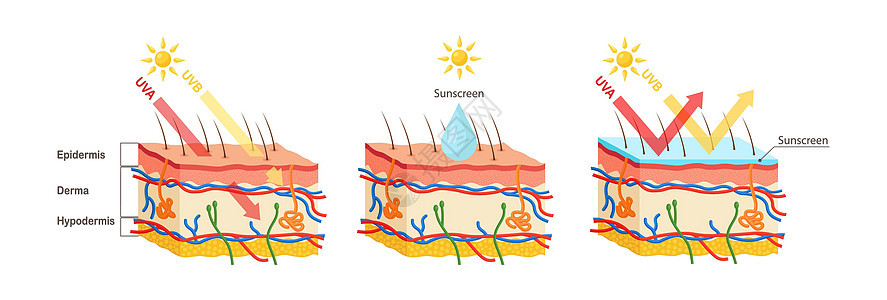 UV防护 日光屏润滑剂保护人类皮肤免受UVA UVB射线的辐射图表棕褐色晒斑反射信息渗透阳光癌症防晒霜晒黑图片