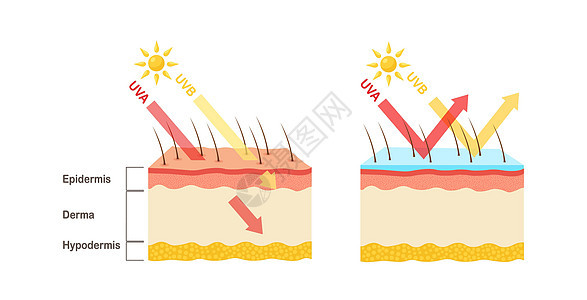 UV防护 日光屏润滑剂保护人类皮肤免受UVA UVB射线的辐射晒斑健康表皮插图阳光癌症皮肤科烧伤太阳损害图片
