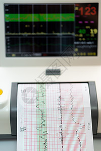 电子心电图机监测子宫胎心收缩 打印心电图报告在怀孕期间在劳动病房出来的心电图 医疗诊断设备医生母亲夫妻病人腹部护理办公室技术女士图片