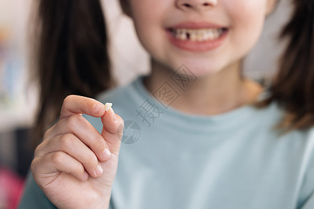 小女孩失去她的乳牙 有牛奶临时牙的小女孩 快乐的孩子手里拿着她掉落的牙齿 牙科医学或临时牙齿保健概念图片