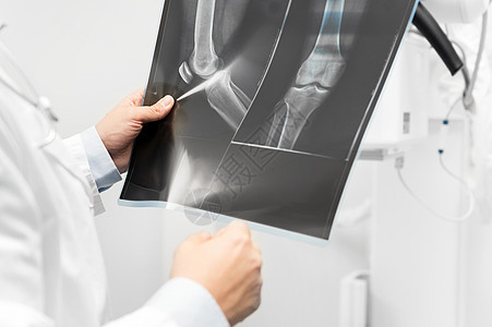 医生在放射室检查一名病人的X光片男性房间医院放射科保健诊断考试电影医疗诊所图片