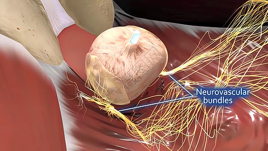 男性生殖器官3D说明解剖病人科学诊所治疗考试医院从业者癌症排尿尿液图片