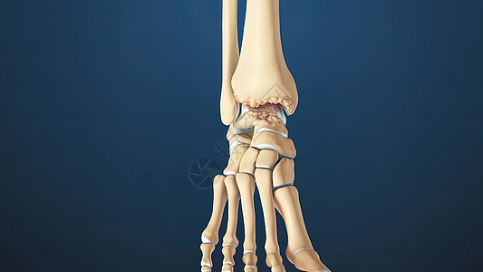 Akle 联合解剖和手动软骨卫生腓骨治疗小腿距骨外科损伤器官药品骨头图片