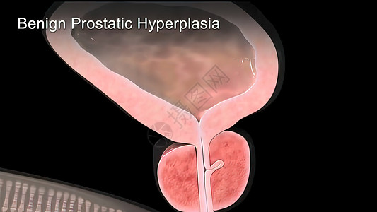 3d医用3d医学男性组织尿频解剖学男人疾病健康膀胱状况器官图片