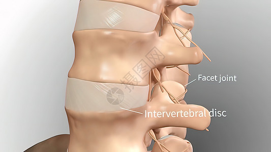 慢性低速后退疼痛 下背痛解剖学脊柱运动药品疾病女士按摩身体男人男性图片