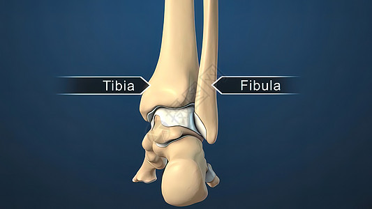 3D医疗伤病员螺丝骨刺软骨关节外科器官距骨骨头保健风湿病背景图片