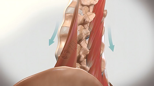 慢性低速后退疼痛 下背痛工人扭伤脊柱按摩肌肉紧张疾病身体成人伤害图片