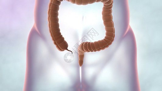 在肠道或肠道癌肿瘤可见的肠透镜检查中 结肠结肠癌外科保健细胞医生预防药品生物学腹部附录医院图片