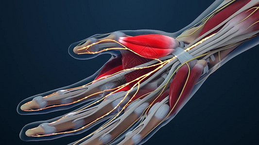 皮肤隧道综合症(CTS)麻木 刺痛或手腕疼痛图片