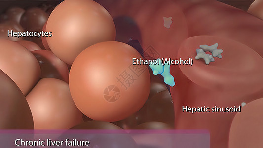 B型肝炎病毒造成的慢性肝衰竭细胞胆囊脂肪酸癌症生物学健康图表外科疼痛信息图片