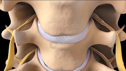 骨关节炎引起的关节损伤是骨刺的最常见原因骨骼人体腰椎骶椎侵蚀腰背胸椎颈椎病考试身体图片