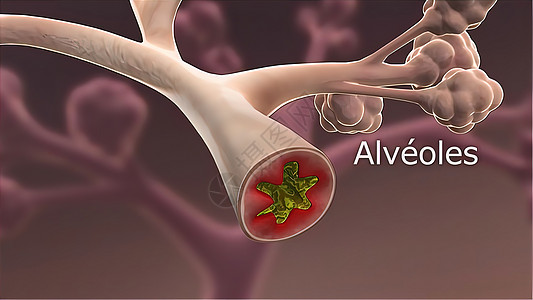 Alveoli医疗呼吸系统 医用插图细胞哮喘肺段生物承包医学流量交换肌纤维呼吸道图片