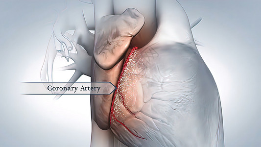 冠状动脉解剖学压力动脉粥样硬化攻击牌匾饮食凝块医学血管油炸危险图片
