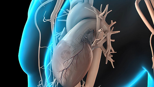 冠状动脉抽搐是这些动脉之一的短暂 突然缩小凝块科学心血管动脉硬化药品动脉粥样硬化危险压力牌匾肥胖背景图片
