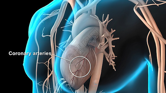 冠状动脉解剖学心血管危险肥胖医学饮食营养凝块动脉粥样硬化动脉细胞图片