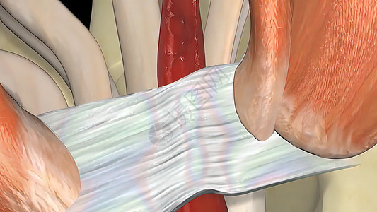 皮肤隧道综合症CTS 麻木 发痒和手腕疼痛手臂扫描皮肤解剖学保健身体诊所手指卫生骨头图片