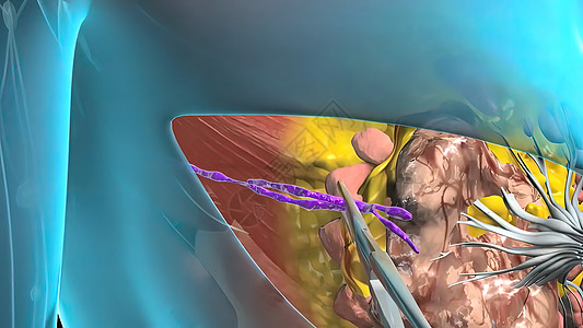 心脏肿瘤生长的外科手术立方体女性地球诊断化疗癌症疾病细胞学胸部生物学图片