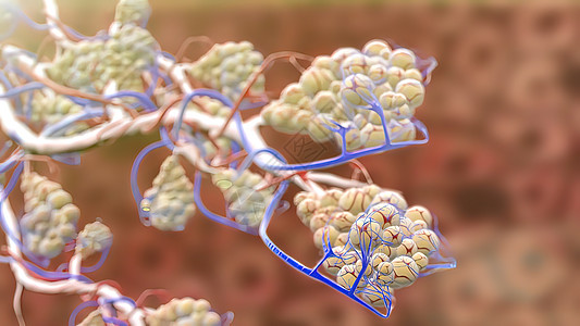 缩放中的 Alveoli 呼吸系统和毛细带承包炎症病理反应过度反应粘液气体免疫学呼吸疾病图片