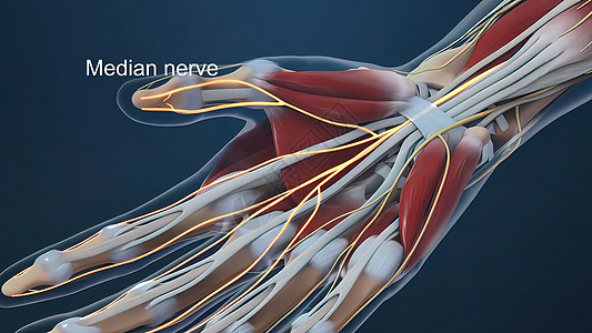 腕管综合症是指正中神经在穿过腕管时受压疼痛解剖学心皮女性科学运动外科疾病腕骨治疗图片