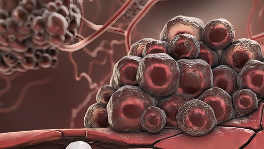 攻击白血细胞的癌症细胞共轭细菌微生物学病原生物学感冒宏观防御癌细胞白细胞图片