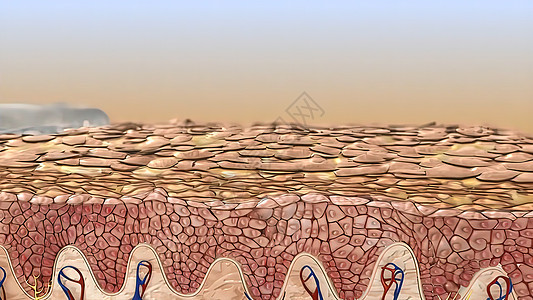皮层是皮肤的外层 被定义为分层结晶的顶部膜表皮湿疹皮炎疼痛干燥症疾病病人药品时间划痕图片
